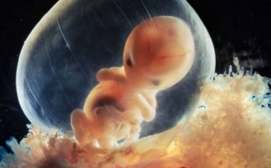 1490168469577746AD37.jpg 01.jpg