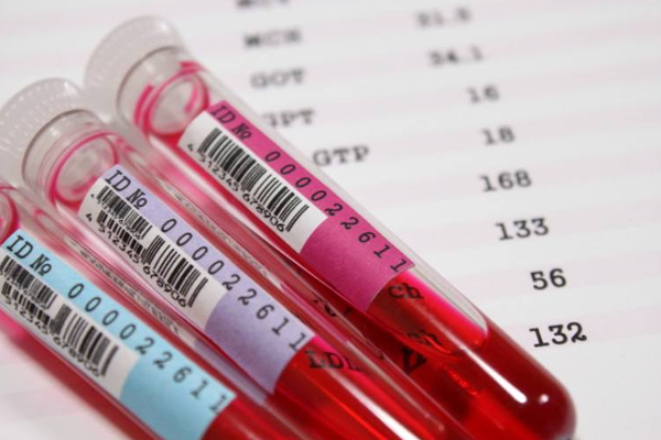 1492481926504126Wv0v.jpg 4.jpg