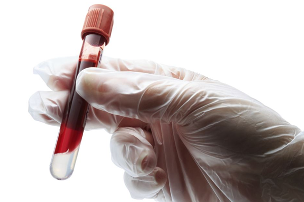 14931015336088708B4z.png 4.png