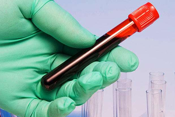 1493172878498280b80s.png 1.png