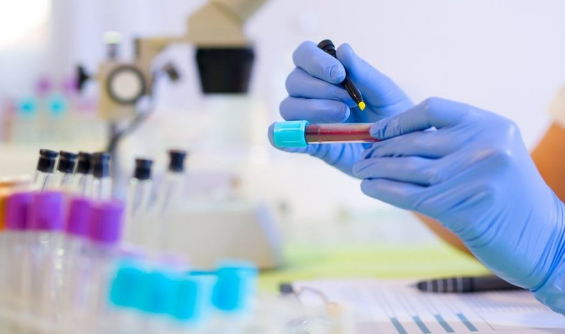 14938661117205718GiZ.png 4.png